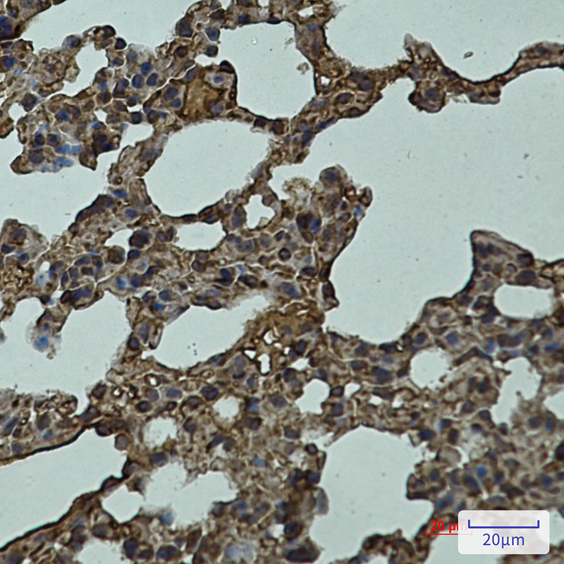Rabbit Monoclonal Antibody to LYVE1