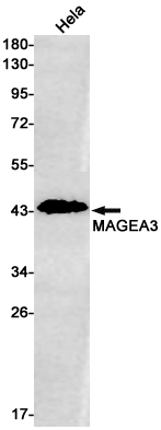MAGEA3