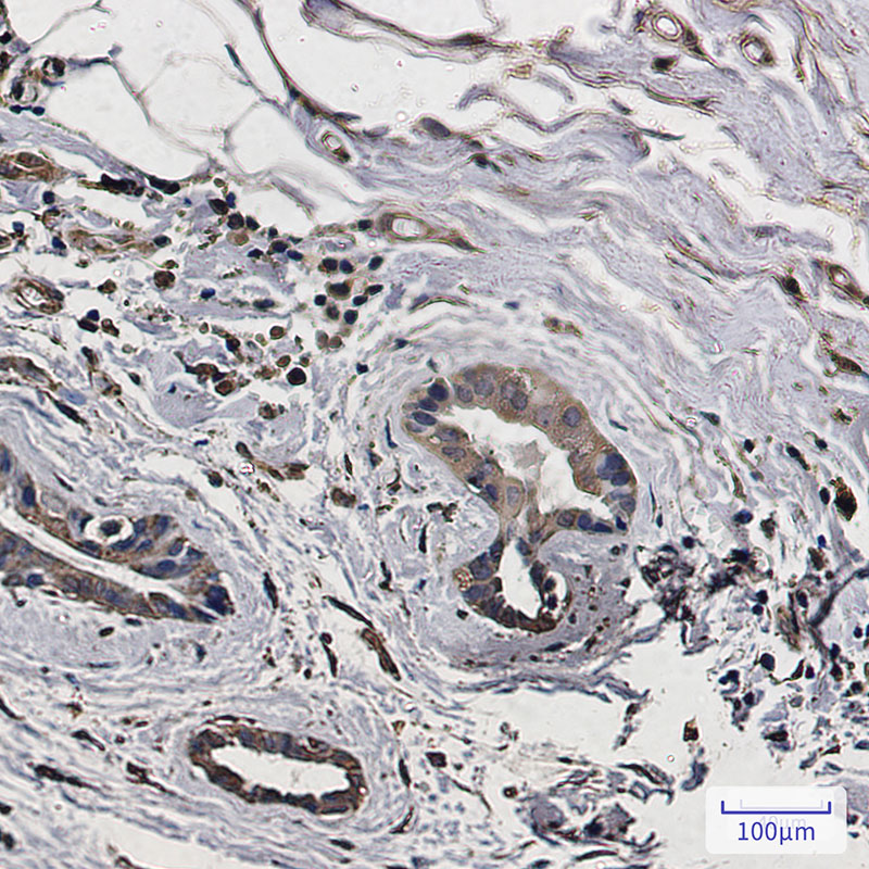 Rabbit Monoclonal Antibody to LC3A