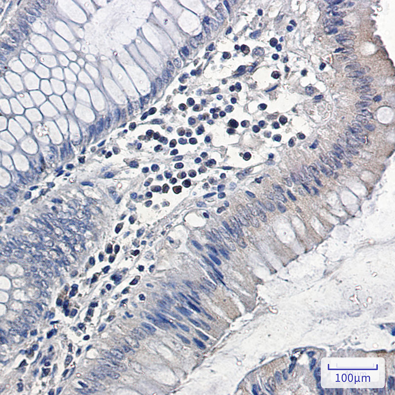 Rabbit Monoclonal Antibody to MAPK6