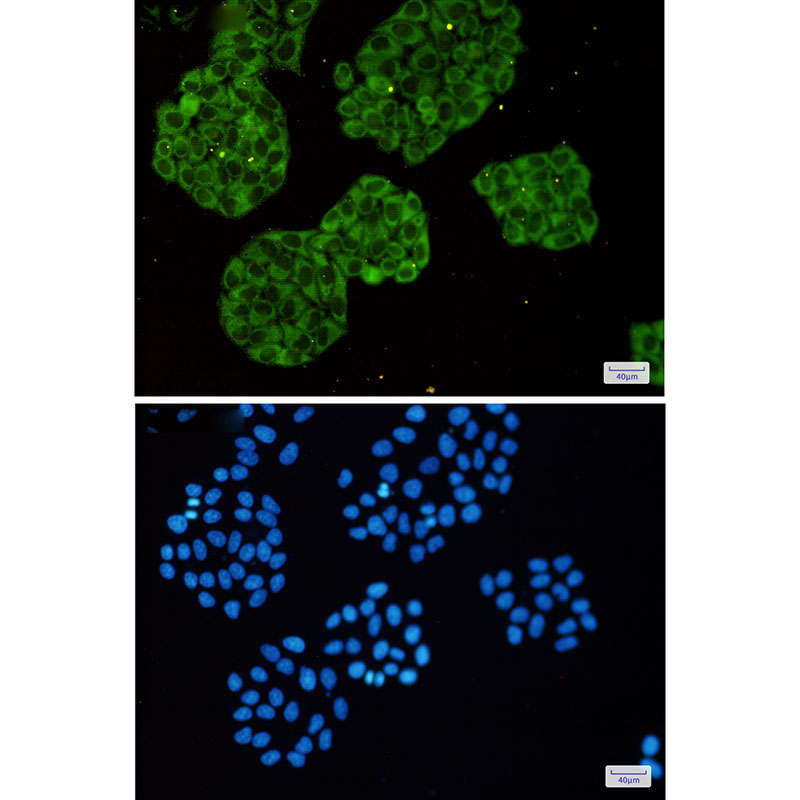 Rabbit Monoclonal Antibody to MetRS