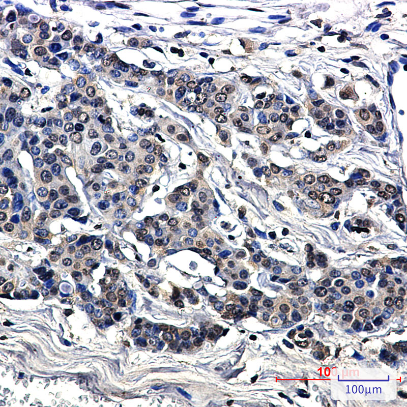 Rabbit Monoclonal Antibody to MetRS
