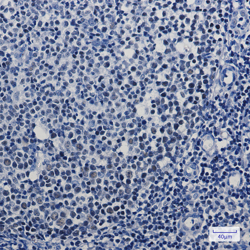 Rabbit Monoclonal Antibody to MBD2