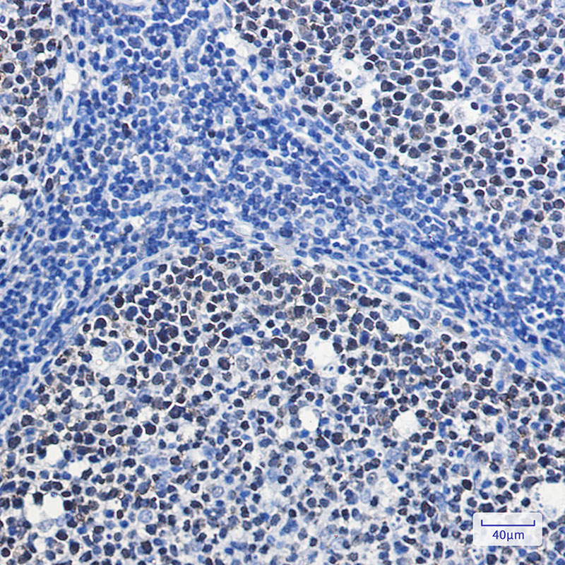 Rabbit Monoclonal Antibody to MCM7