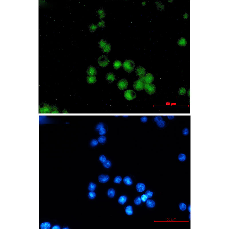 Rabbit Monoclonal Antibody to MEF2A