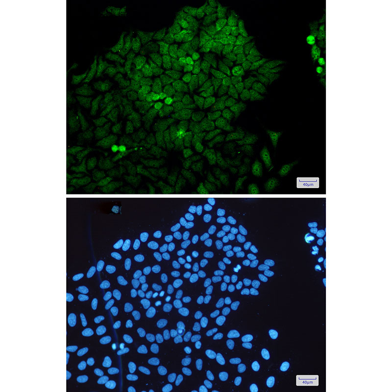 Rabbit Monoclonal Antibody to MEK3