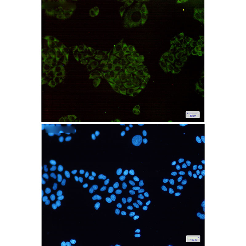 Rabbit Monoclonal Antibody to MEKK2