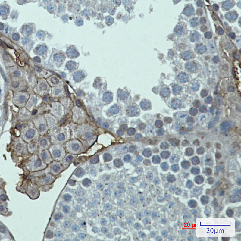 Rabbit Monoclonal Antibody to Metabotropic Glutamate Receptor 2
