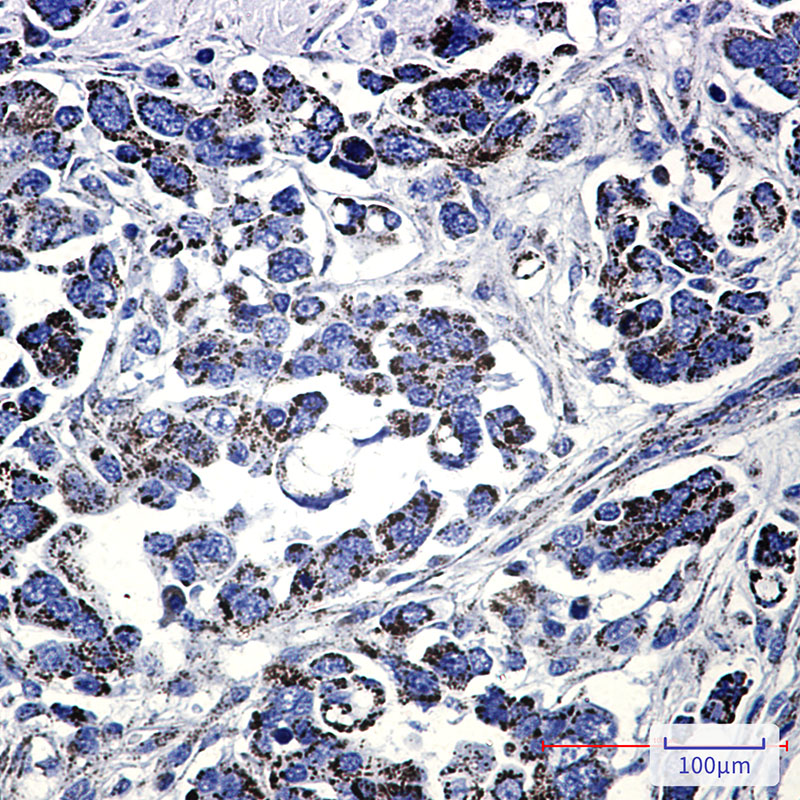 Rabbit Monoclonal Antibody to Methylmalonyl Coenzyme A mutase