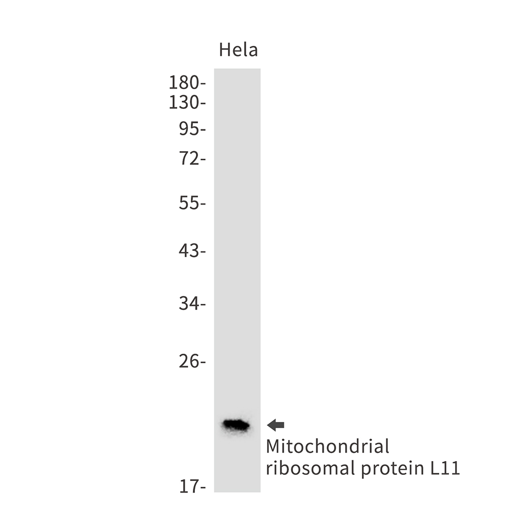 Mitochondrial Ribosomal Protein L11