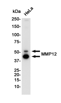 MMP12