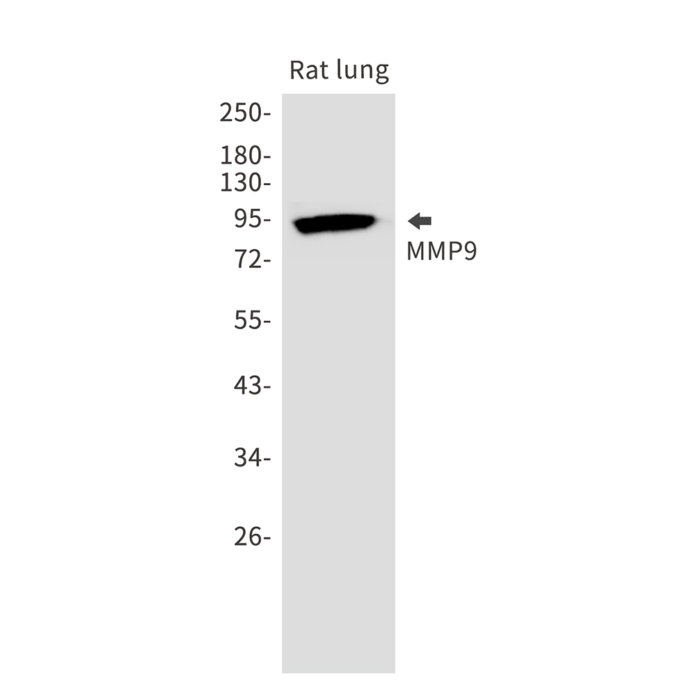 MMP9