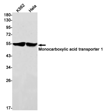 Monocarboxylic Acid Transporter 1
