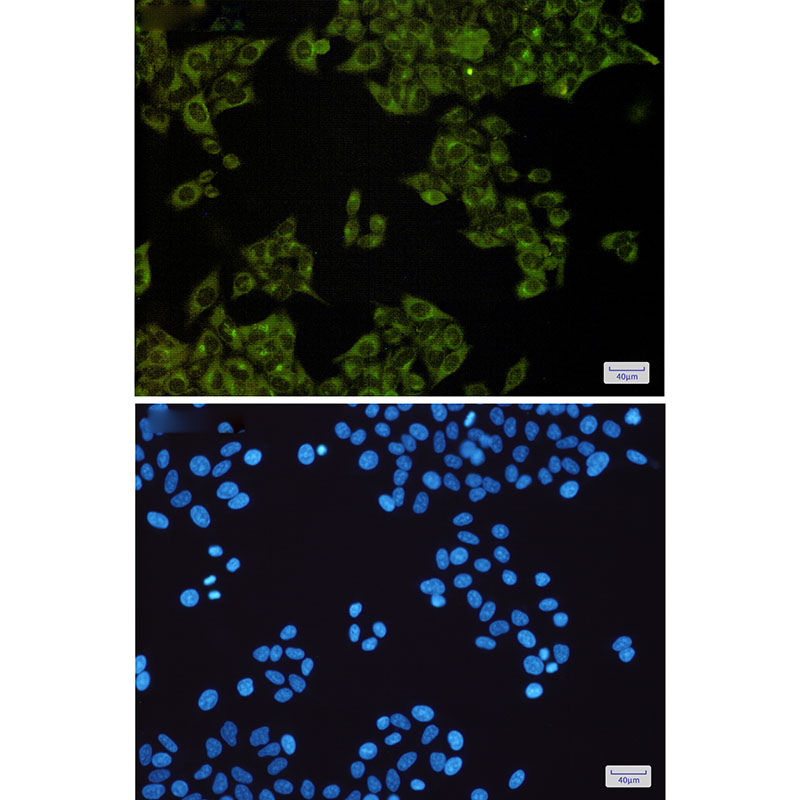 Rabbit Monoclonal Antibody to MST4