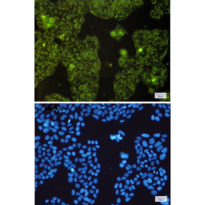 Rabbit Monoclonal Antibody to MTCO2