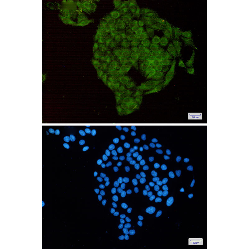 Rabbit Monoclonal Antibody to MTH1