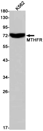 Rabbit Monoclonal Antibody to MTHFR