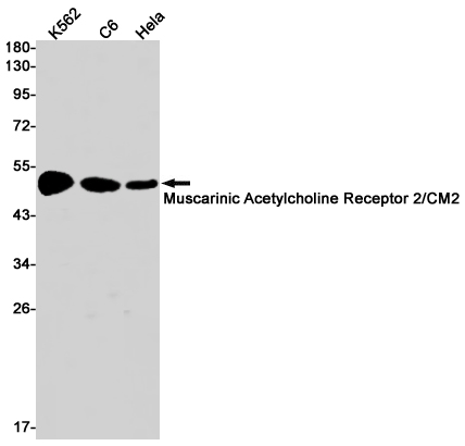 Muscarinic Acetylcholine Receptor M2