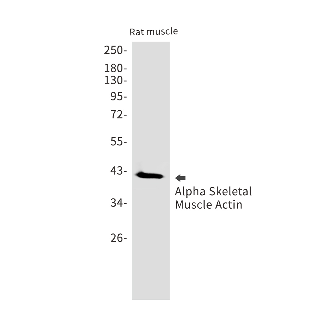 alpha Skeletal Muscle Actin