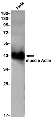 Rabbit Monoclonal Antibody to alpha Skeletal Muscle Actin