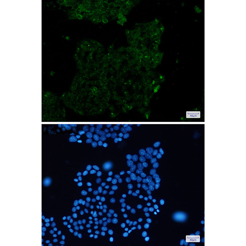 Rabbit Monoclonal Antibody to alpha Skeletal Muscle Actin
