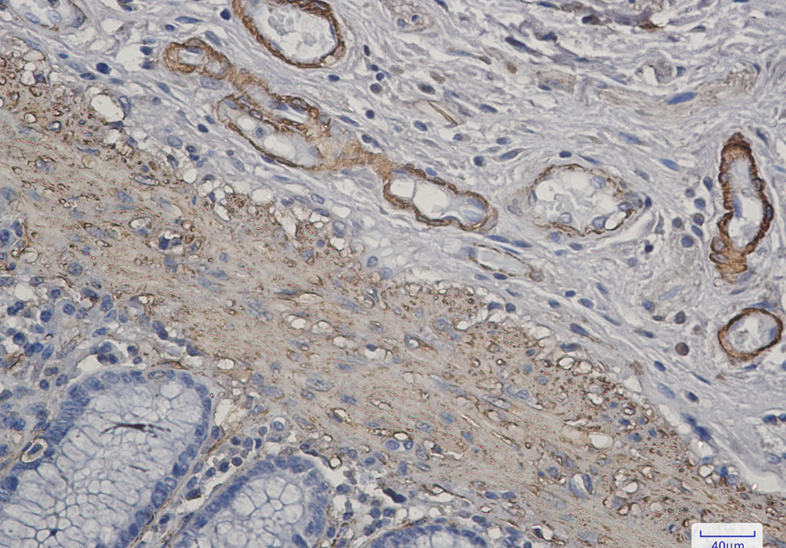 Rabbit Monoclonal Antibody to alpha Skeletal Muscle Actin
