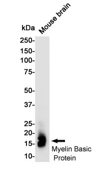 Myelin Basic Protein