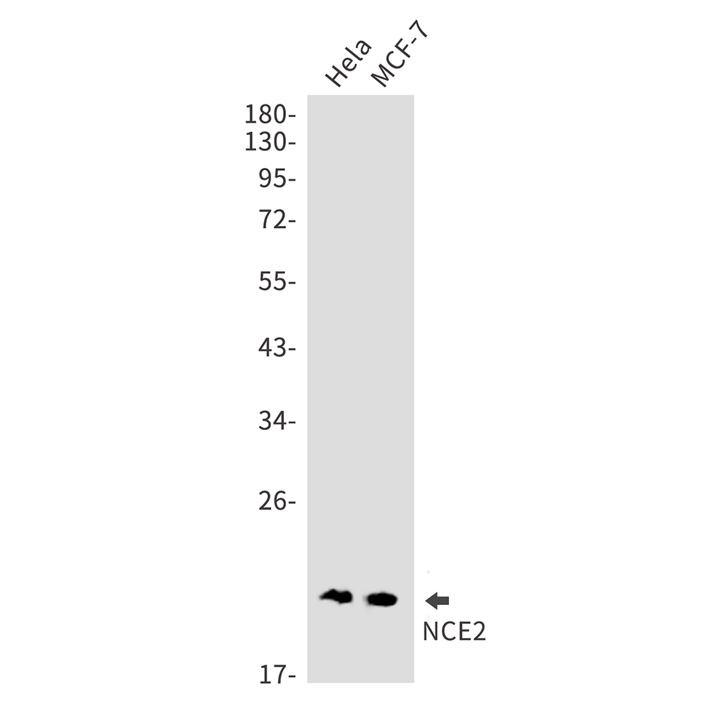 NCE2