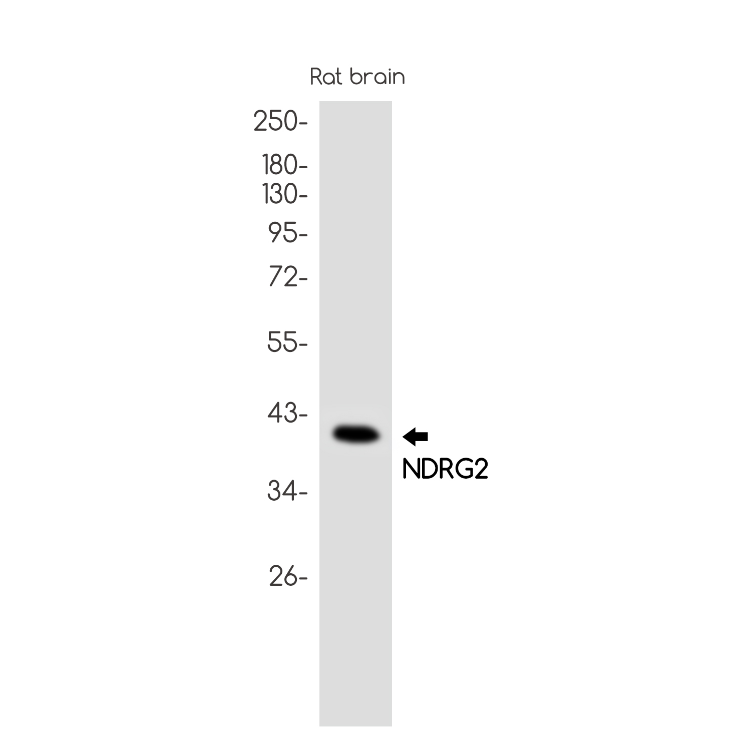 NDRG2