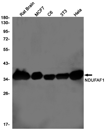 NDUFAF1