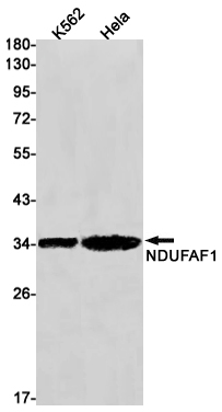 NDUFAF1