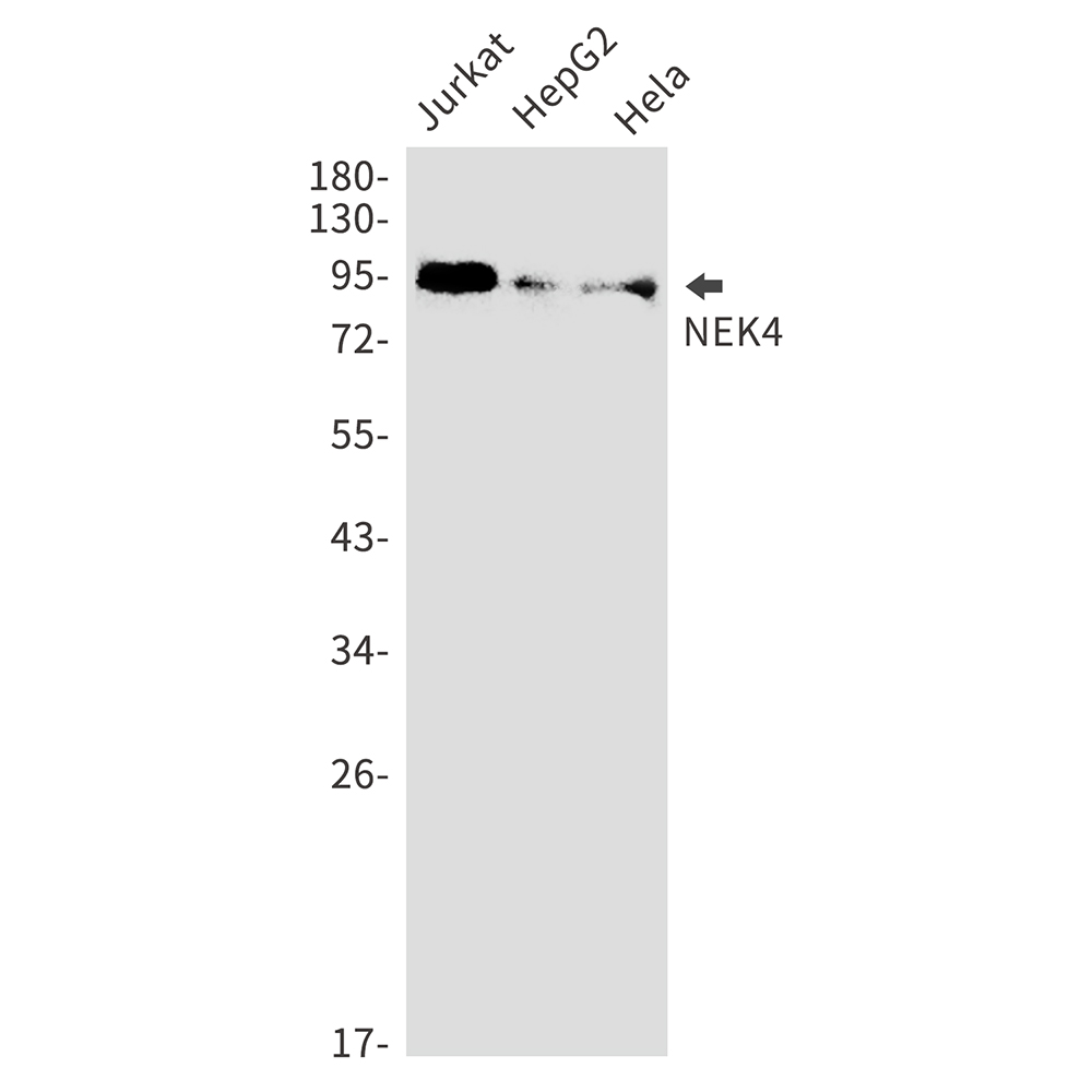 NEK4