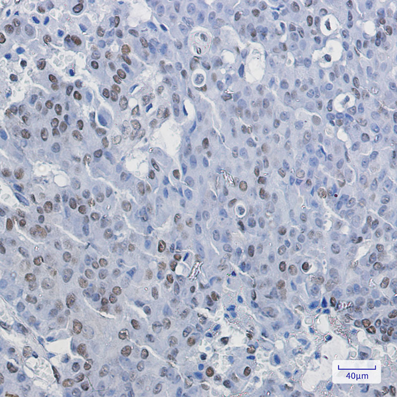 Rabbit Monoclonal Antibody to NELFE