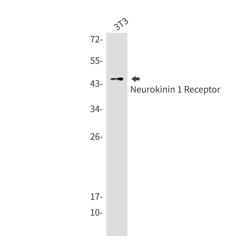 Neurokinin 1 Receptor