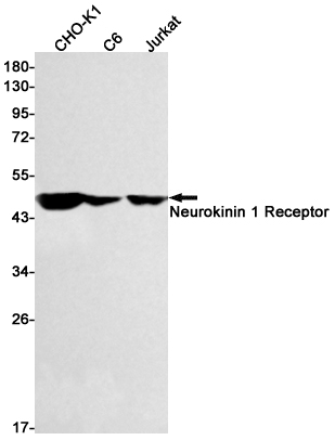 Rabbit Monoclonal Antibody to Neurokinin 1 Receptor
