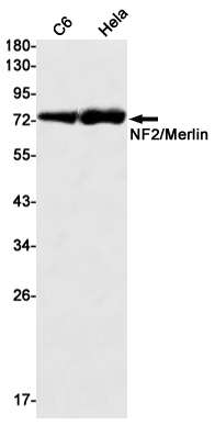 Rabbit Monoclonal Antibody to NF2