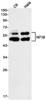 NFIB