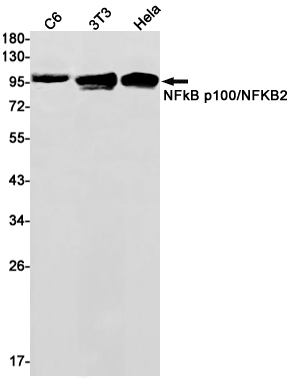 NF-KB p100