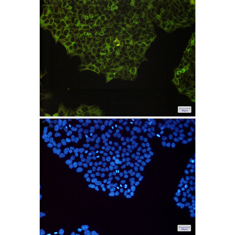 Rabbit Monoclonal Antibody to NF-KB p100