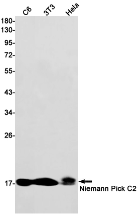 Niemann Pick C2