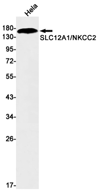 SLC12A1