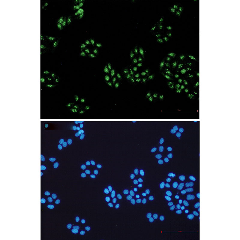 Rabbit Monoclonal Antibody to NOLC1