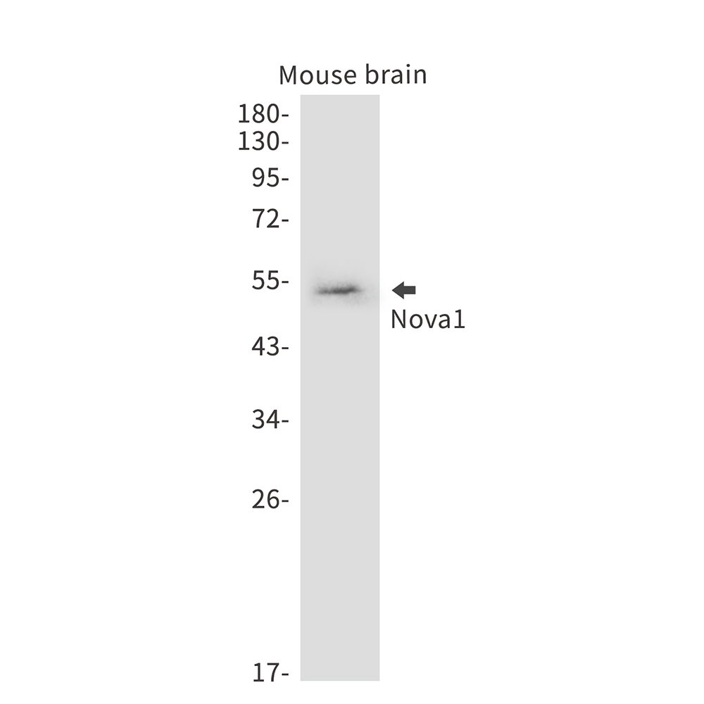 Nova1