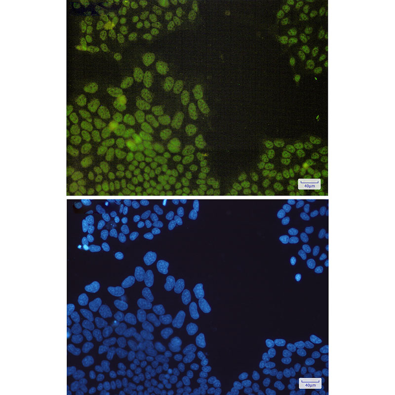 Rabbit Monoclonal Antibody to Nrf1