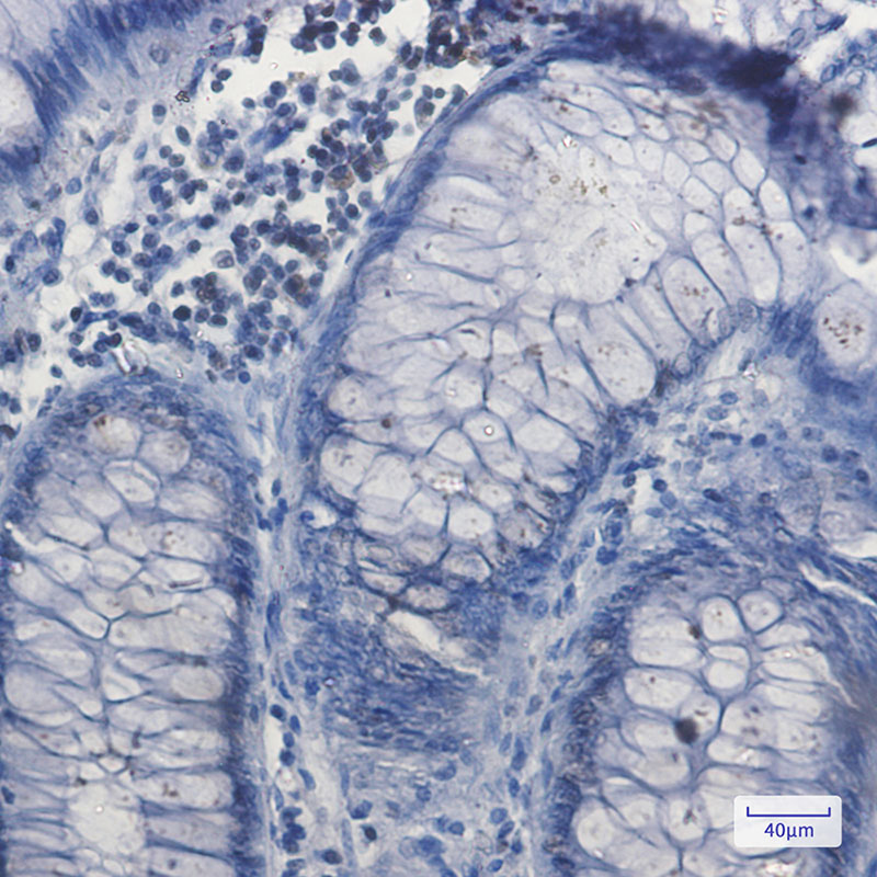 Rabbit Monoclonal Antibody to Nrf1