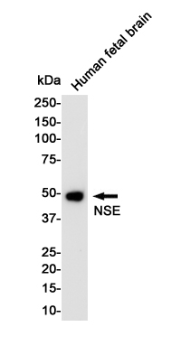 NSE