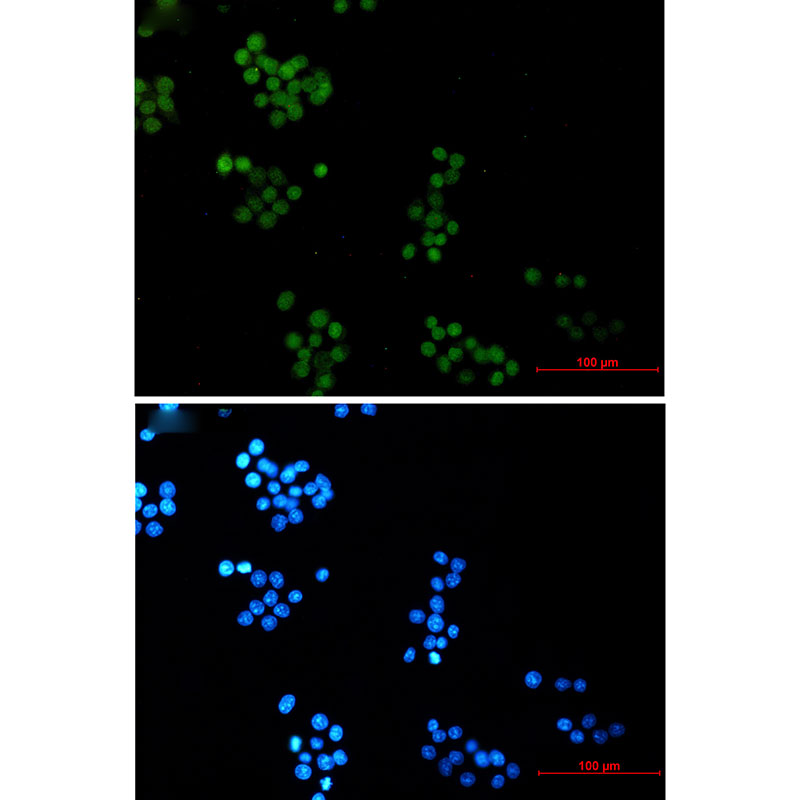 Rabbit Monoclonal Antibody to NTH1