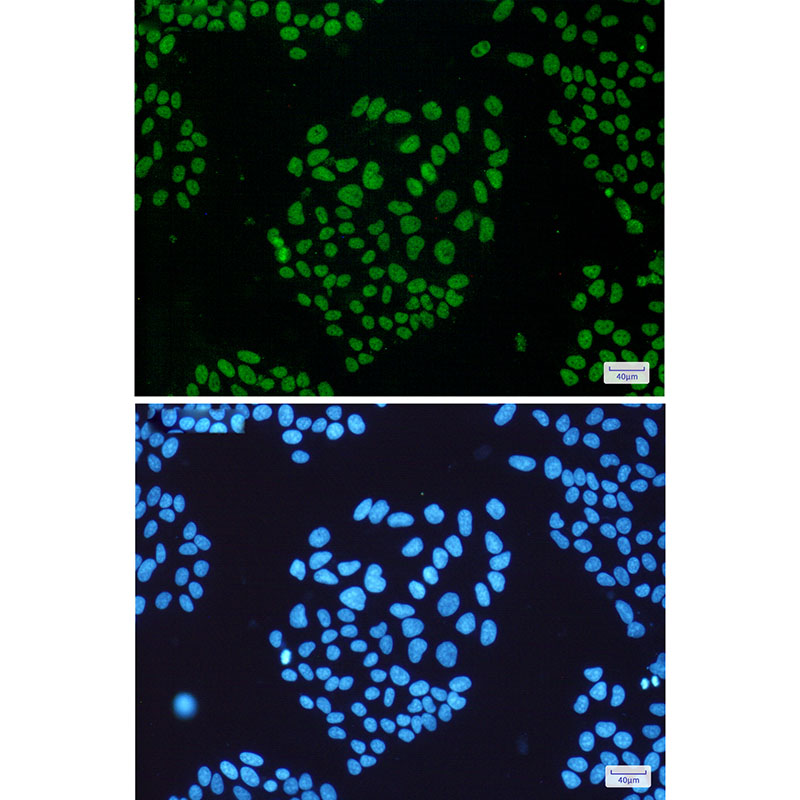 Rabbit Monoclonal Antibody to THO Complex Subunit 1