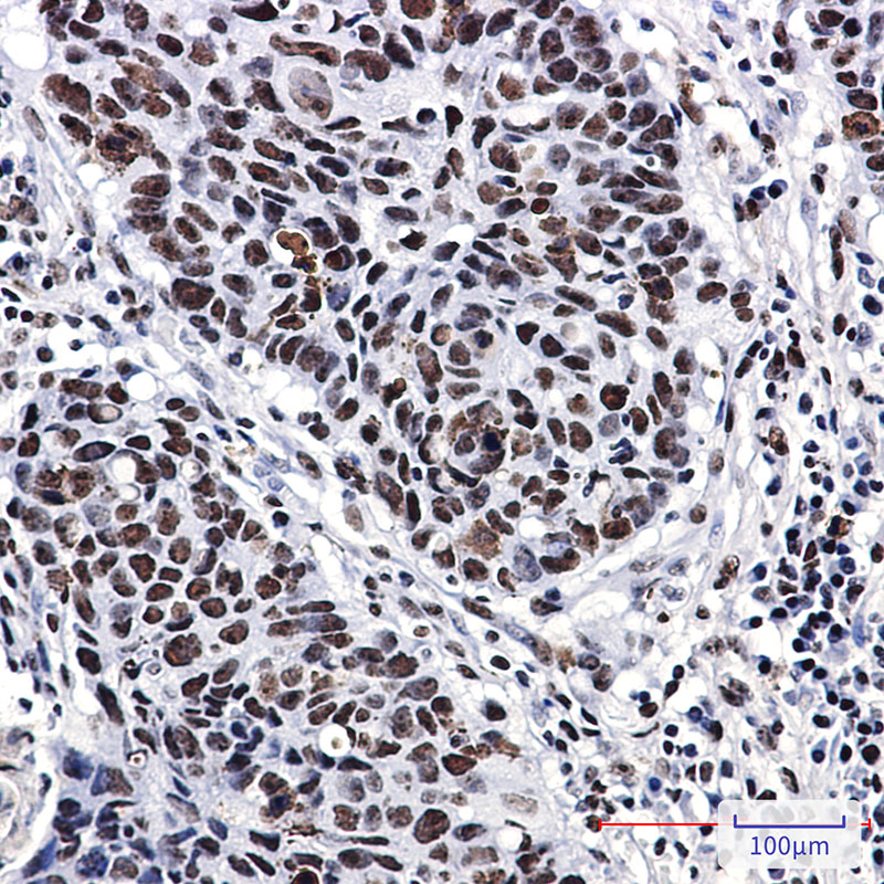 Rabbit Monoclonal Antibody to Nucleophosmin