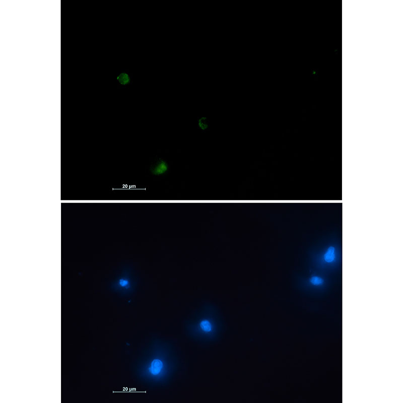 Rabbit Monoclonal Antibody to NUDT19